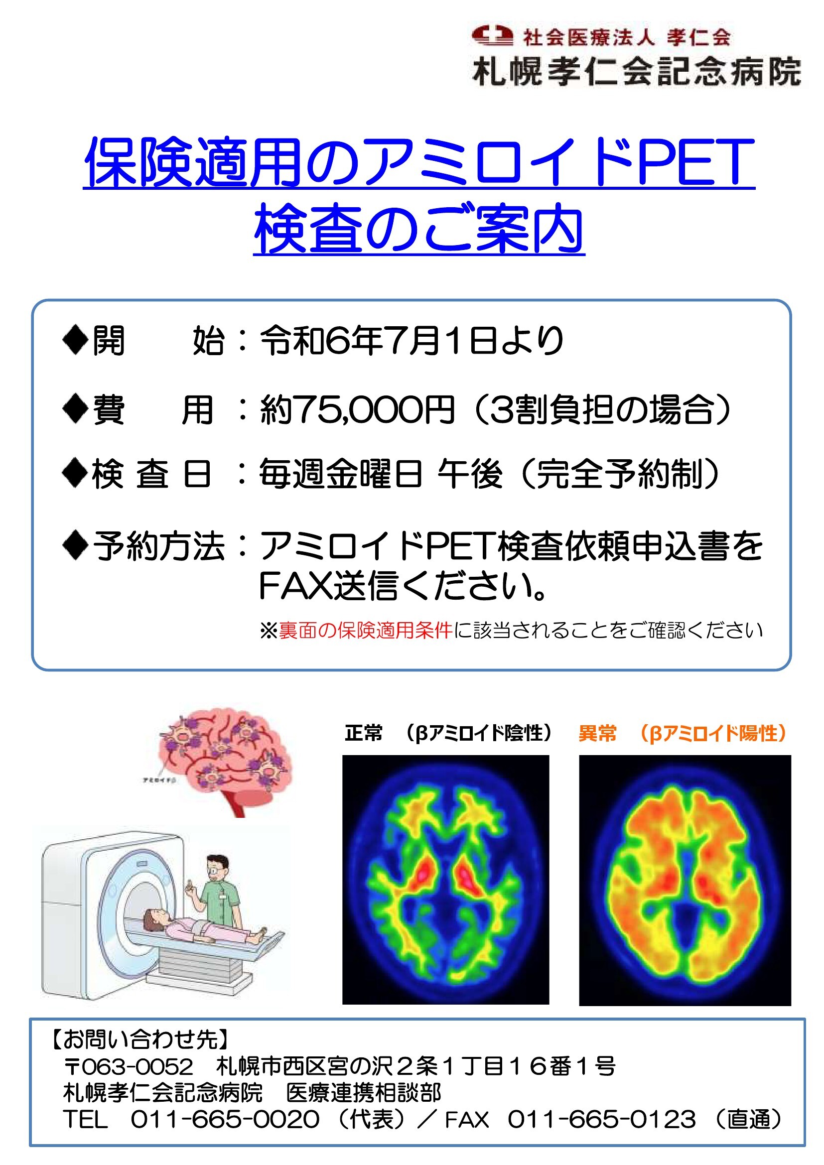 アミロイドPET検査0001